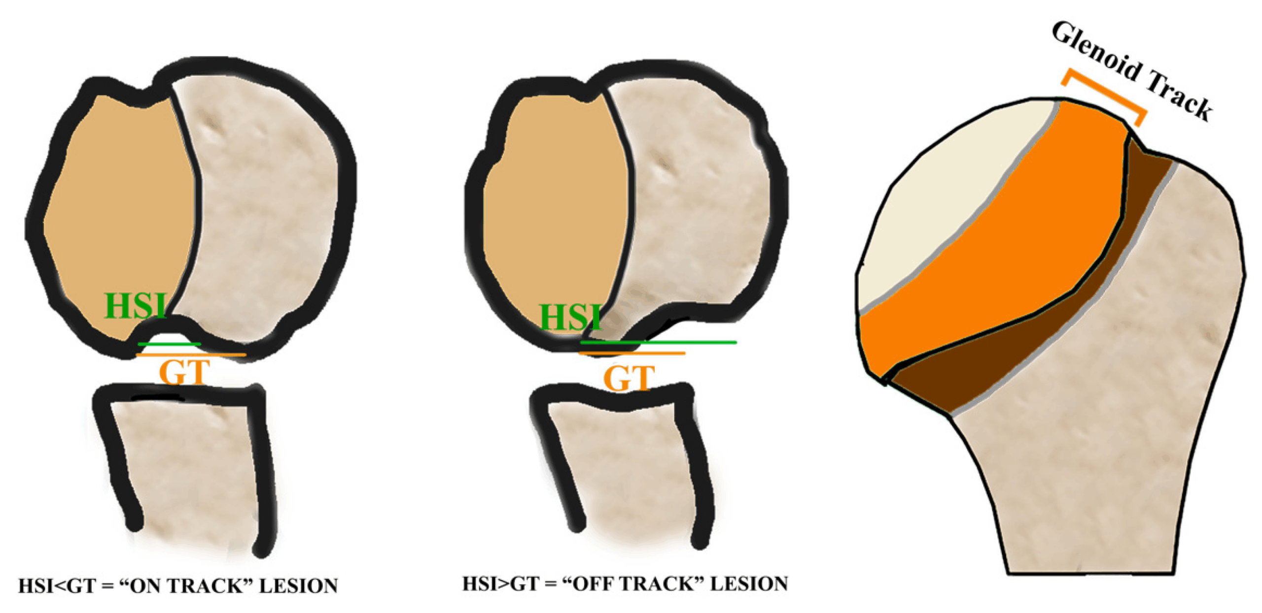 An application scenario or product detail of track vs tract - Image 11